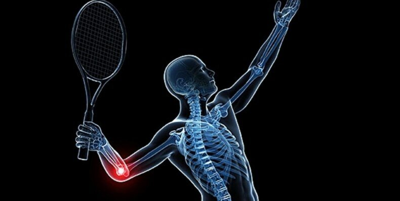 most arm friendly tennis strings